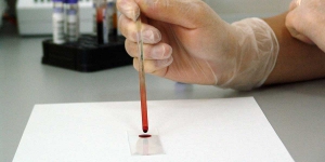 Transport of saliva samples and other cares