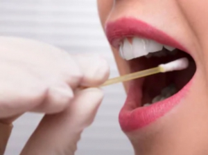 transport of saliva samples