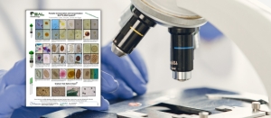 REAL Intestinal Parasites Poster