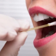 transport of saliva samples